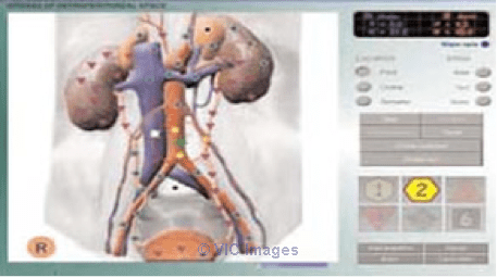 The Beauty Of The ETA Scan - thehealthcorner.ca     