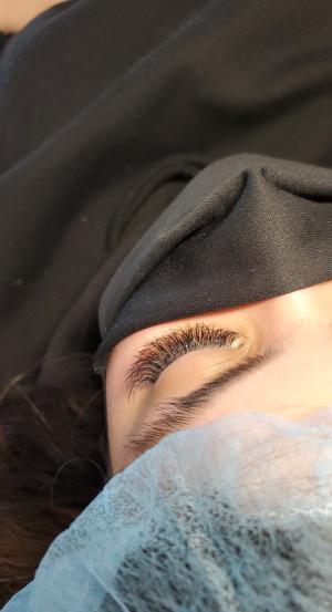 Eyelash extension montreal  microneedling 