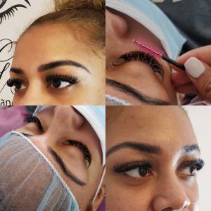 Microneedling Treatment 80$