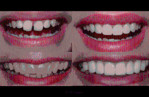 Smile Dentistry Toronto - Comfortable and affordable