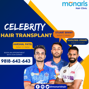 Hair Transplant in Indore