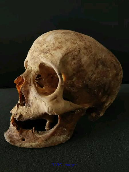 De vrais os humains a vendre/ Real Human Bones for sale