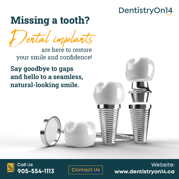 Root Canal Therapy Markham