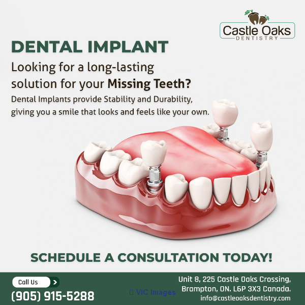 Root Canal therapy in Brampton