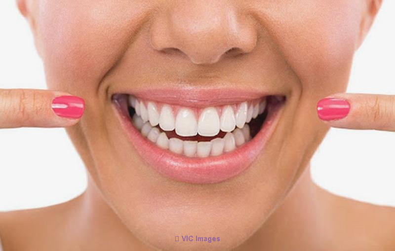 Dental Implants in Toronto