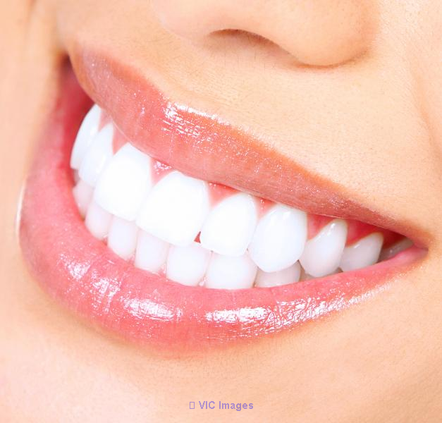 TEETH WHITENING IN TORONTO, ON