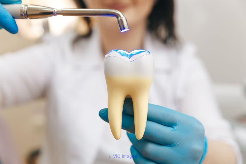 Tooth Filling In Vancouver |