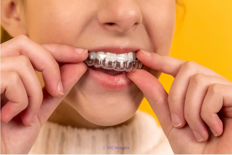 Dental Invisalign in Burnaby | Invisalign Braces in Burnaby