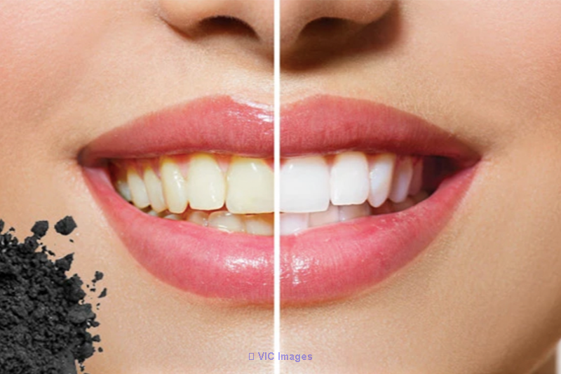 Teeth whitening in Woodbridge | Dental Specialists Group