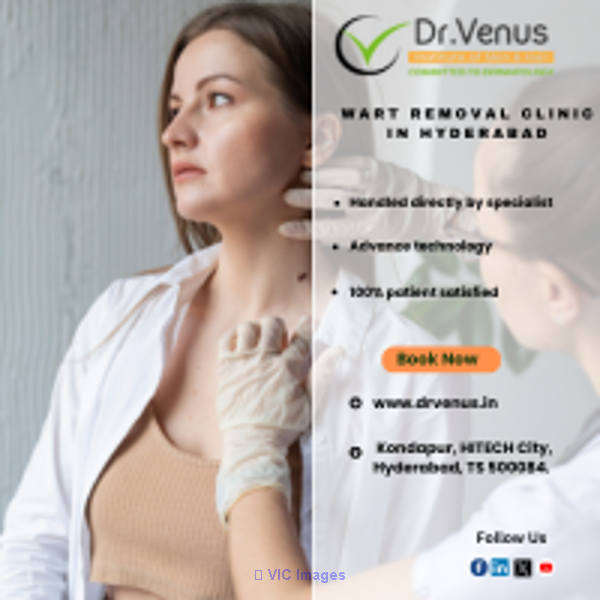 Wart Removal Clinic in Hyderabad