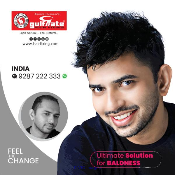 BEST HAIR FIXING IN KERALA INDIA |NON-SURGICAL HAIR REPLACEMENT
