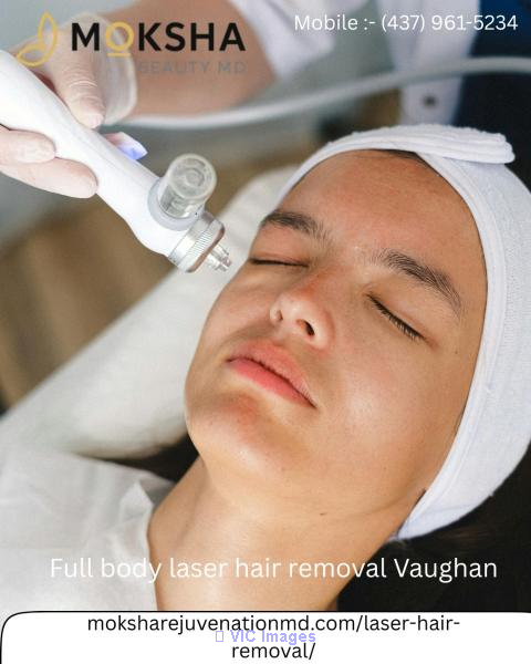 Full body laser hair removal Vaughan