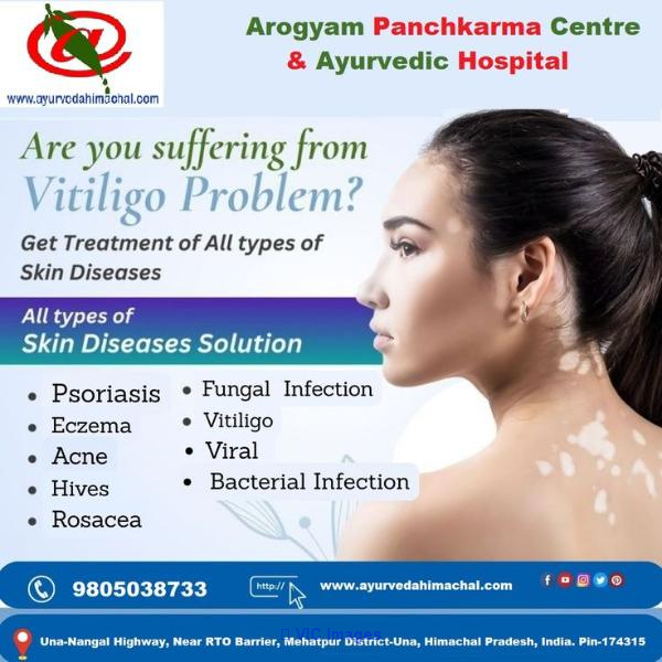 AROGYAM PURE HERBS KIT FOR VITILIGO