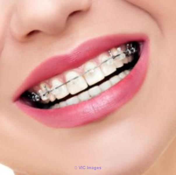 Dental Health Care